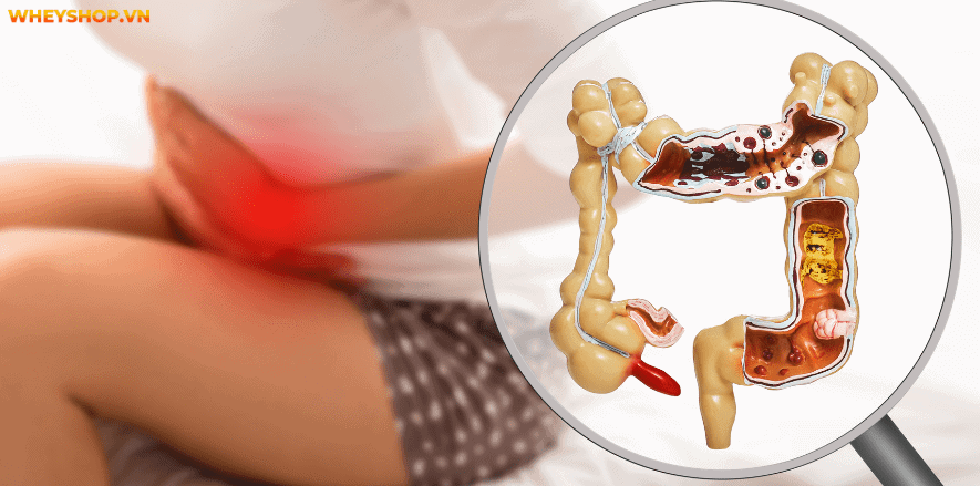 Ăn rất nhiều thực phẩm tươi ngon, giàu chất dinh dưỡng, nhưng không bao giờ tăng cân được. Hãy cùng WheyShop tìm hiểu tại sao ăn nhiều vẫn gầy....