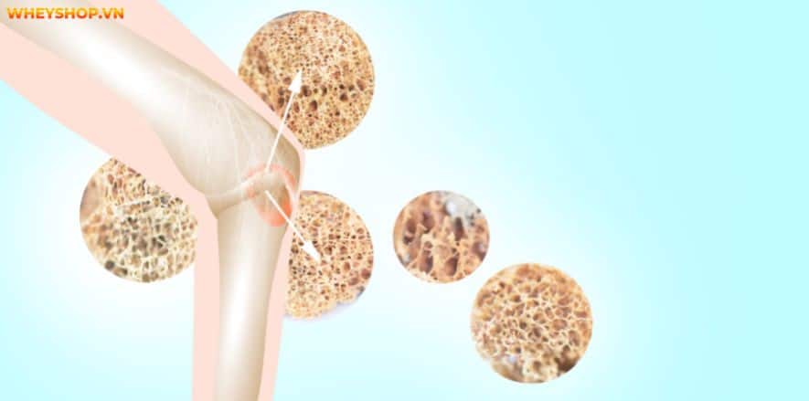 Thông tin "Whey Rule 1 ung thư" đã và đang làm cộng đồng Gymer chao đảo, lo lắng. Cùng WheyShop kiểm chứng thông tin Whey Rule 1 ung thư....