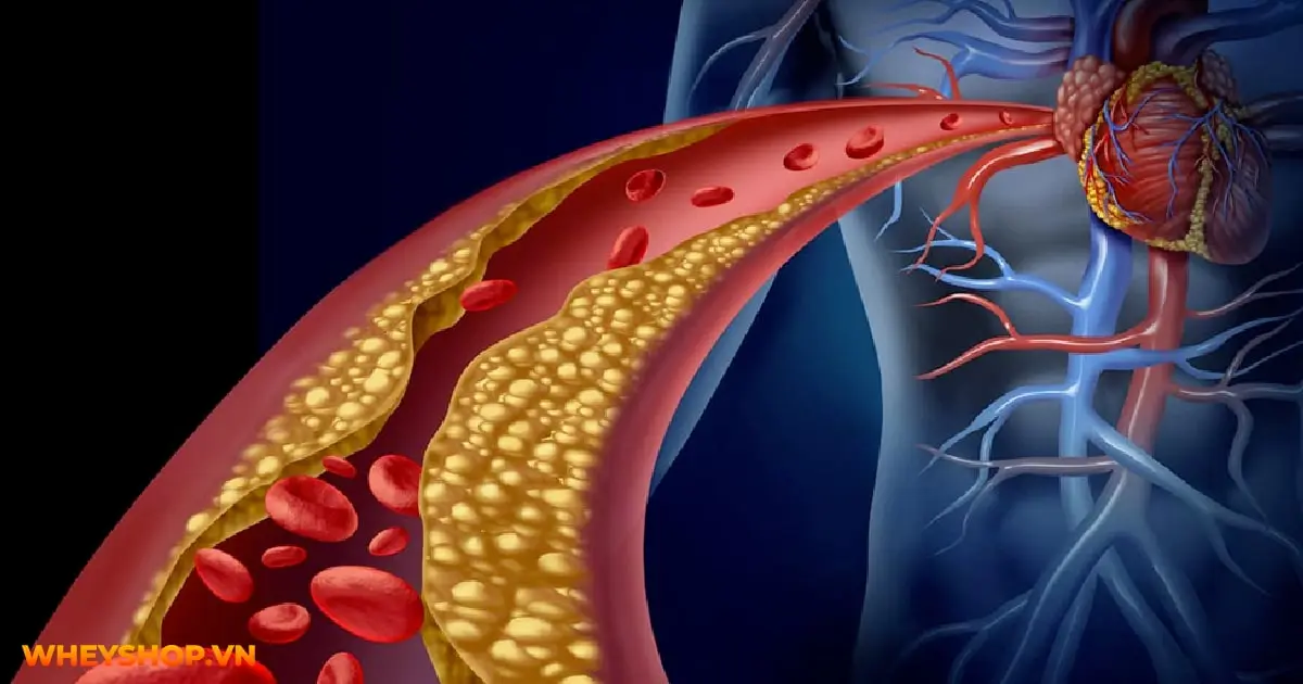 tim-hieu-ve-cholesterol-nhung-dieu-can-biet-03-min