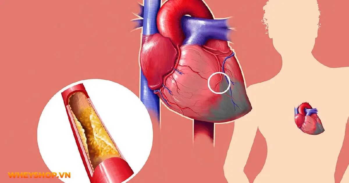 tim-hieu-ve-cholesterol-nhung-dieu-can-biet-03-min