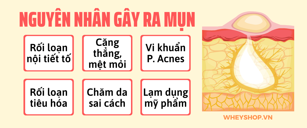 Hiện nay có rất nhiều cách trị mụn: dùng kem trị mụn, dùng thuốc trị mụn, trị mụn bằng công nghệ cao tại các spa, cơ sở thẩm mỹ như lăn kim không cần lăn...