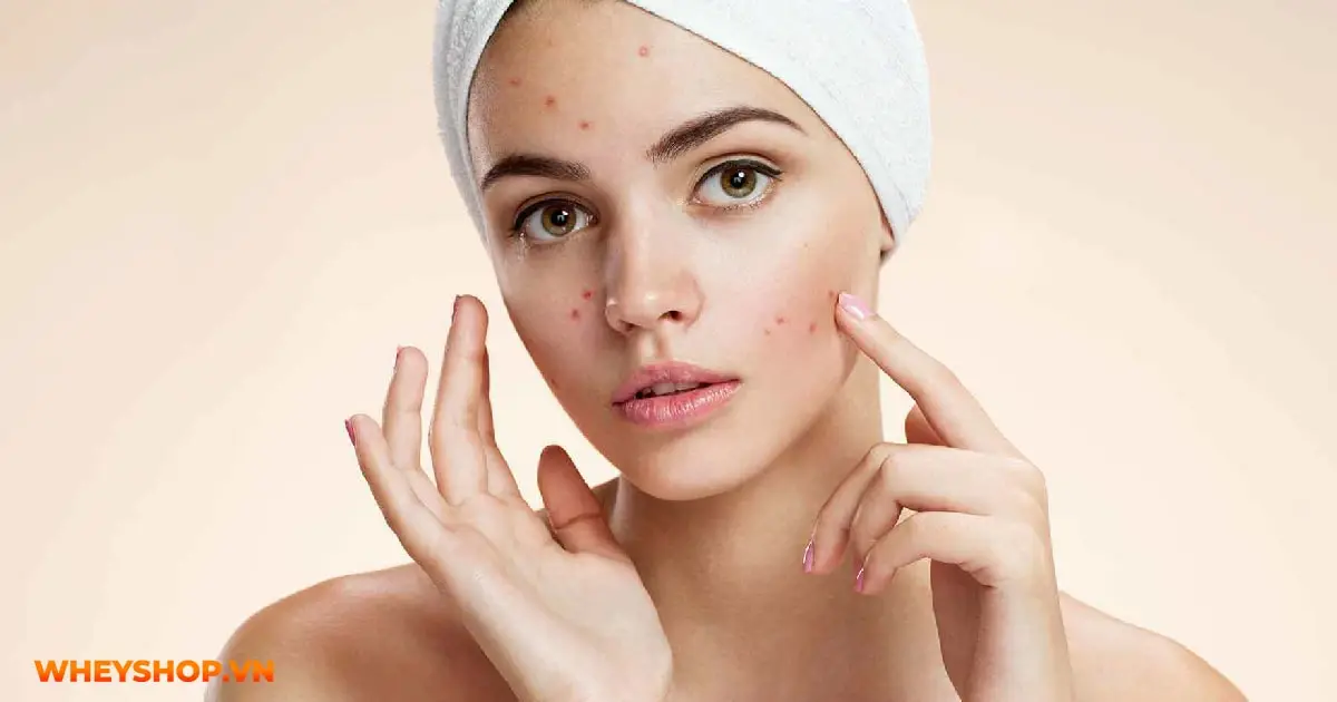 sản phẩm skincare cho da dầu mụn lỗ chân lông to