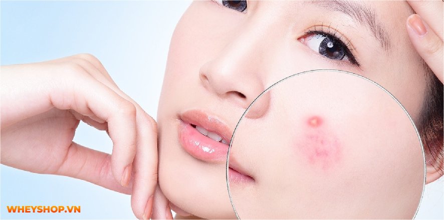 Mass Gainer luôn là dòng sữa tăng cân vô cùng hiệu quả được nhiều người tin dùng. Cùng Whey Shop giải đáp thắc mắc uống Mass có hại không....