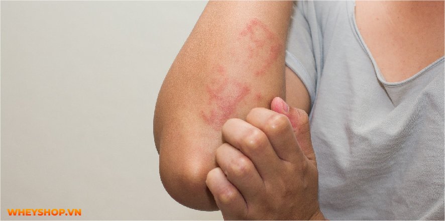 Mass Gainer luôn là dòng sữa tăng cân vô cùng hiệu quả được nhiều người tin dùng. Cùng Whey Shop giải đáp thắc mắc uống Mass có hại không....