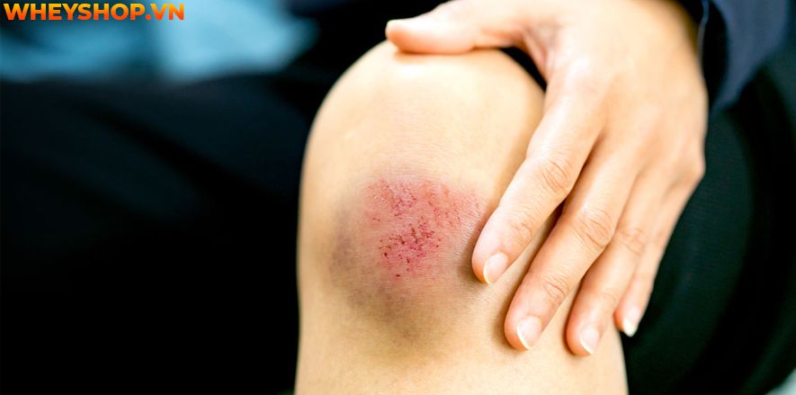 Nếu bạn đang băn khoăn uống mật ong trước khi ngủ giảm cân hay không thì hãy cùng WheyShop tìm hiểu 5 cách uống mật ong trước khi ngủ giảm cân...