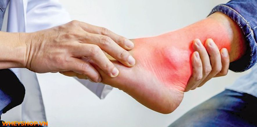 Nếu bạn đang băn khoăn uống nước lá vối có tác dụng giảm cân không thì hãy cùng WheyShop tham khảo chi tiết bài viết sau đây để giải đáp...