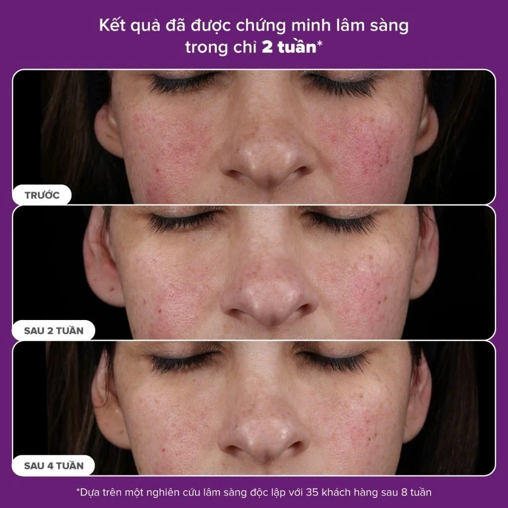 Tinh chất ngăn ngừa lão hóa và căng bóng da mặt Paula's Choice PRO Retinaldehyde Treatment 30ml