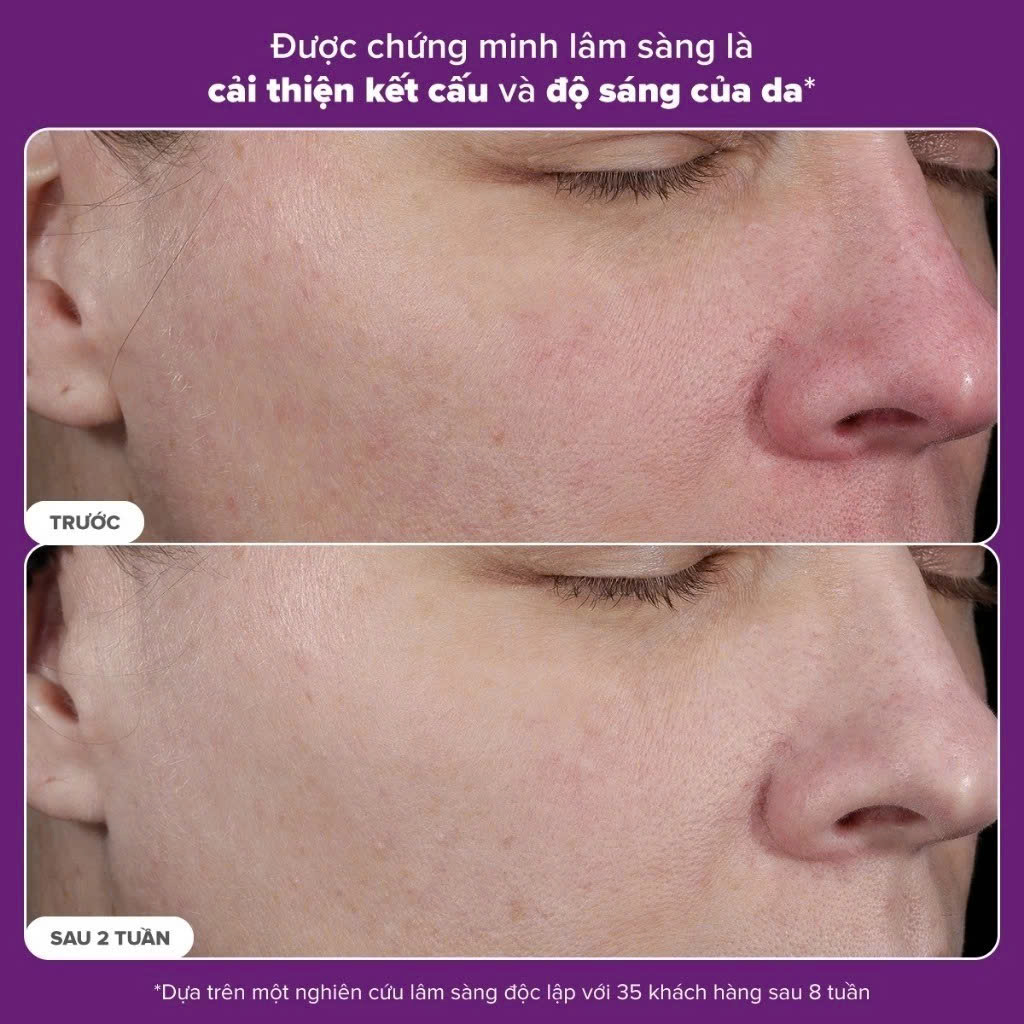 Tinh chất ngăn ngừa lão hóa và căng bóng da mặt Paula's Choice PRO Retinaldehyde Treatment 30ml