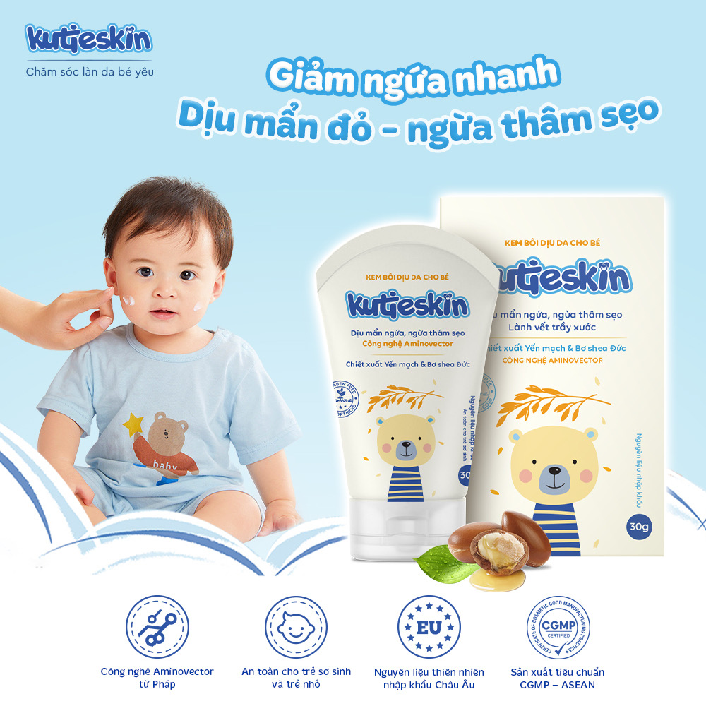 Kem dịu mẩn ngứa, ngừa thâm sẹo cho bé