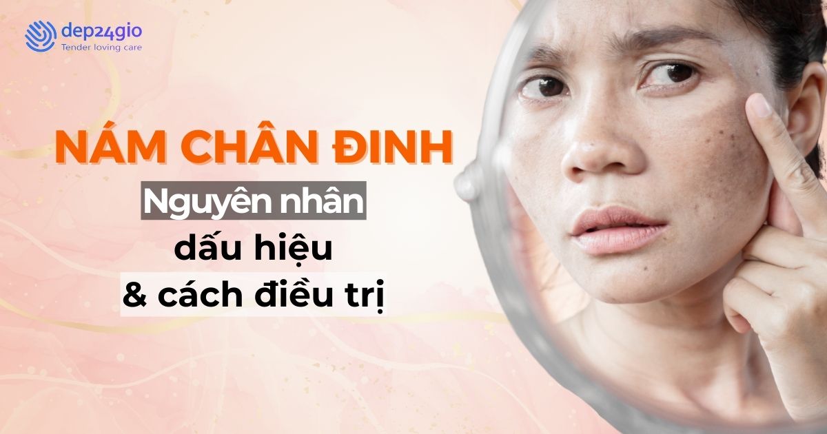 Nám chân đinh: Nguyên nhân, dấu hiệu và cách điều trị