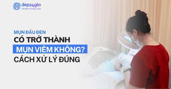 Mụn đầu đen có trở thành mụn viêm không? Cách xử lý đúng