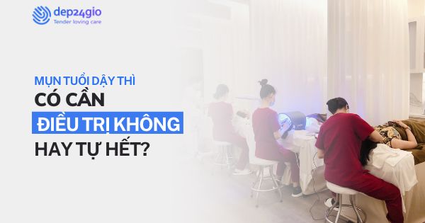 Mụn tuổi dậy thì có cần điều trị không hay tự hết?