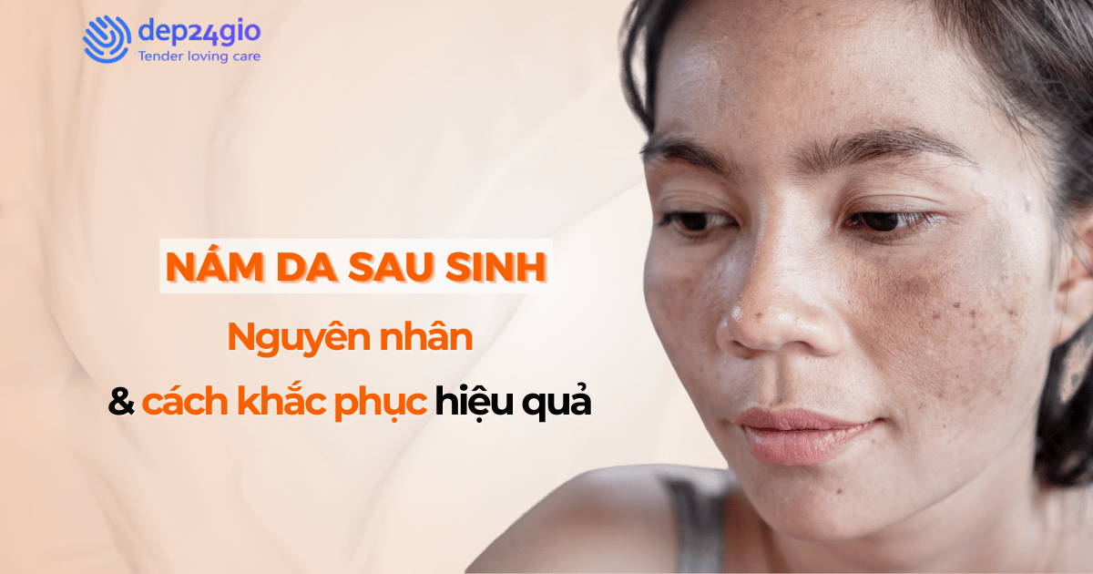 Nám da sau sinh: Nguyên nhân và cách khắc phục hiệu quả