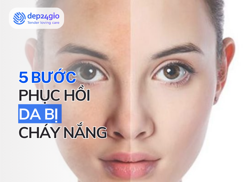Da bị cháy nắng: 5 bước phục hồi