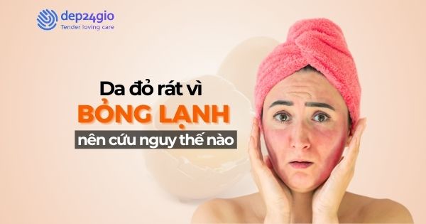 Da đỏ rát vì bỏng lạnh nên cứu nguy thế nào