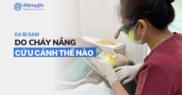 Da bị sạm do cháy nắng - Chữa cháy bằng cách nào