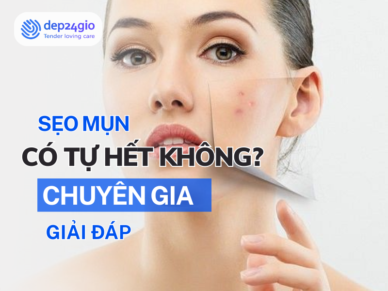 Sẹo mụn có tự hết không? Chuyên gia giải đáp