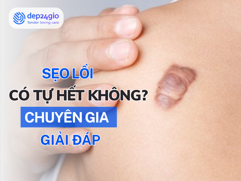 Sẹo lồi có tự hết không? Chuyên gia giải đáp