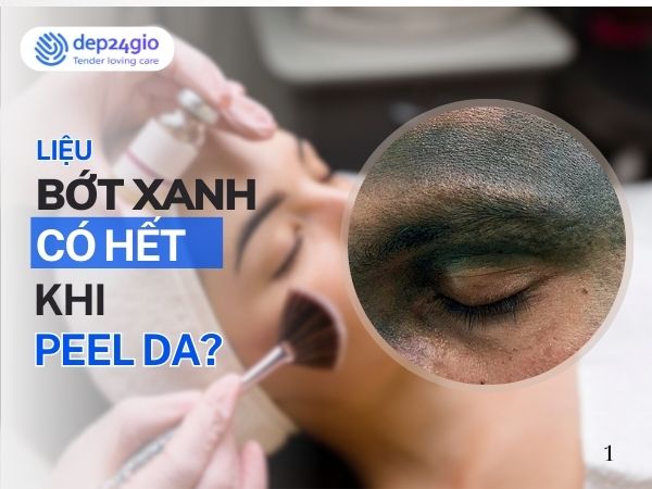Bớt xanh trên mặt có hết khi peel da không?
