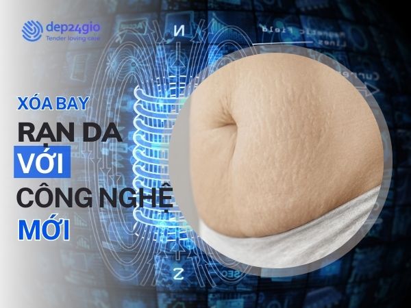 Cách Trị Rạn Da An Toàn Bằng Công Nghệ Biodermogenesi