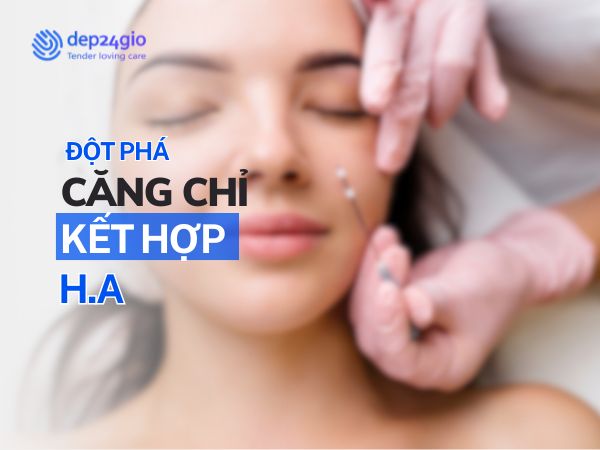 Căng chỉ da mặt với công nghệ kết hợp H.A