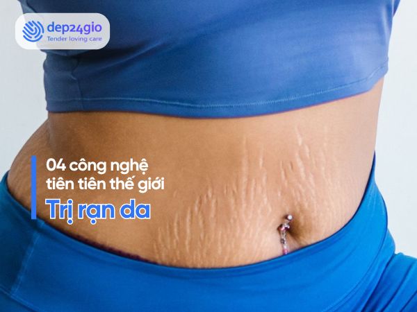 4 Công Nghệ Trị Rạn Da Tiên Tiến Giúp Làn Da Săn Chắc Trở Lại