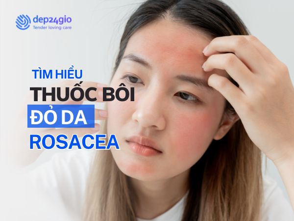 Mặt Bị Đỏ 2 Bên Má: Giải Pháp Thuốc Bôi Cho Rosacea