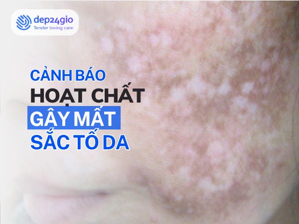 Hoạt chất gây mất sắc tố da – Chuyên gia cảnh báo