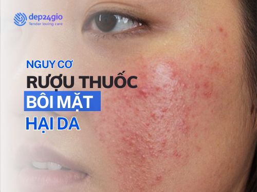Nguy Cơ Rượu Thuốc Bôi Mặt: Hại Da Nghiêm Trọng