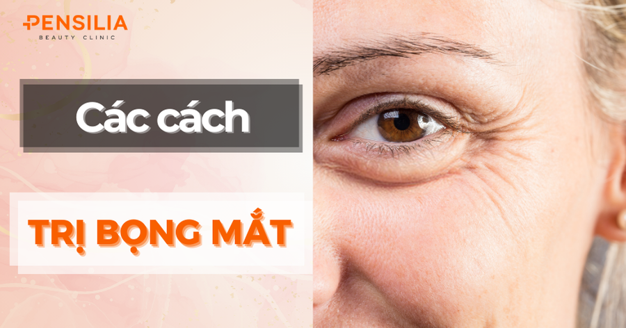 Cách trị bọng mắt hiệu quả: Giải pháp từ chuyên gia