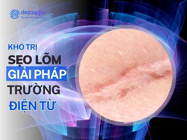 Tại Sao Trị Sẹo Lõm Khó? Giải Pháp Biodermogenesi Hiệu Quả