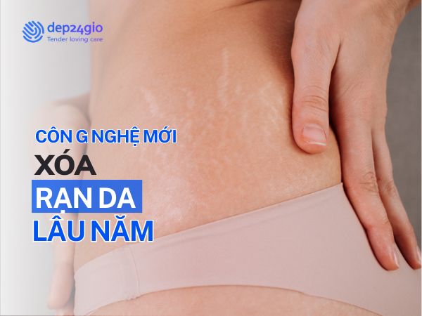 Xóa rạn da vĩnh viễn: Bí quyết hiệu quả từ công nghệ mới