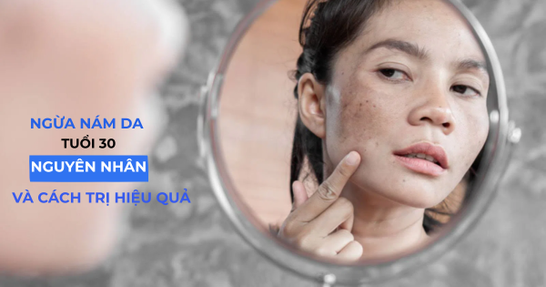 Ngừa nám da tuổi 30: Nguyên nhân và cách trị hiệu quả