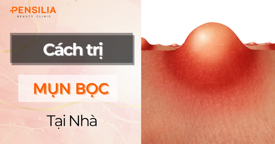 Cách Trị Mụn Bọc Tại Nhà Với Nguyên Liệu Tự Nhiên: Hiệu Quả Và An Toàn