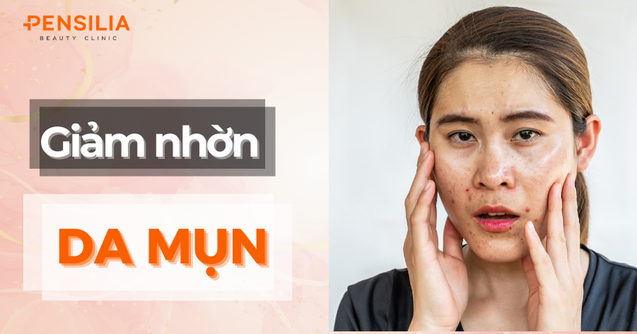 Cách Giảm Nhờn Cho Da Mụn: Hướng Dẫn Từ A Đến Z