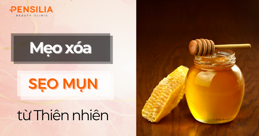 Mẹo Trị Sẹo Mụn Hiệu Quả: Phương Pháp Tự Nhiên An Toàn