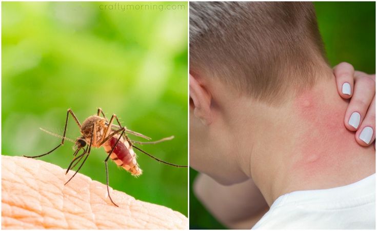 5 loại cây trồng giúp xua đuổi côn trùng hiệu quả và an toàn