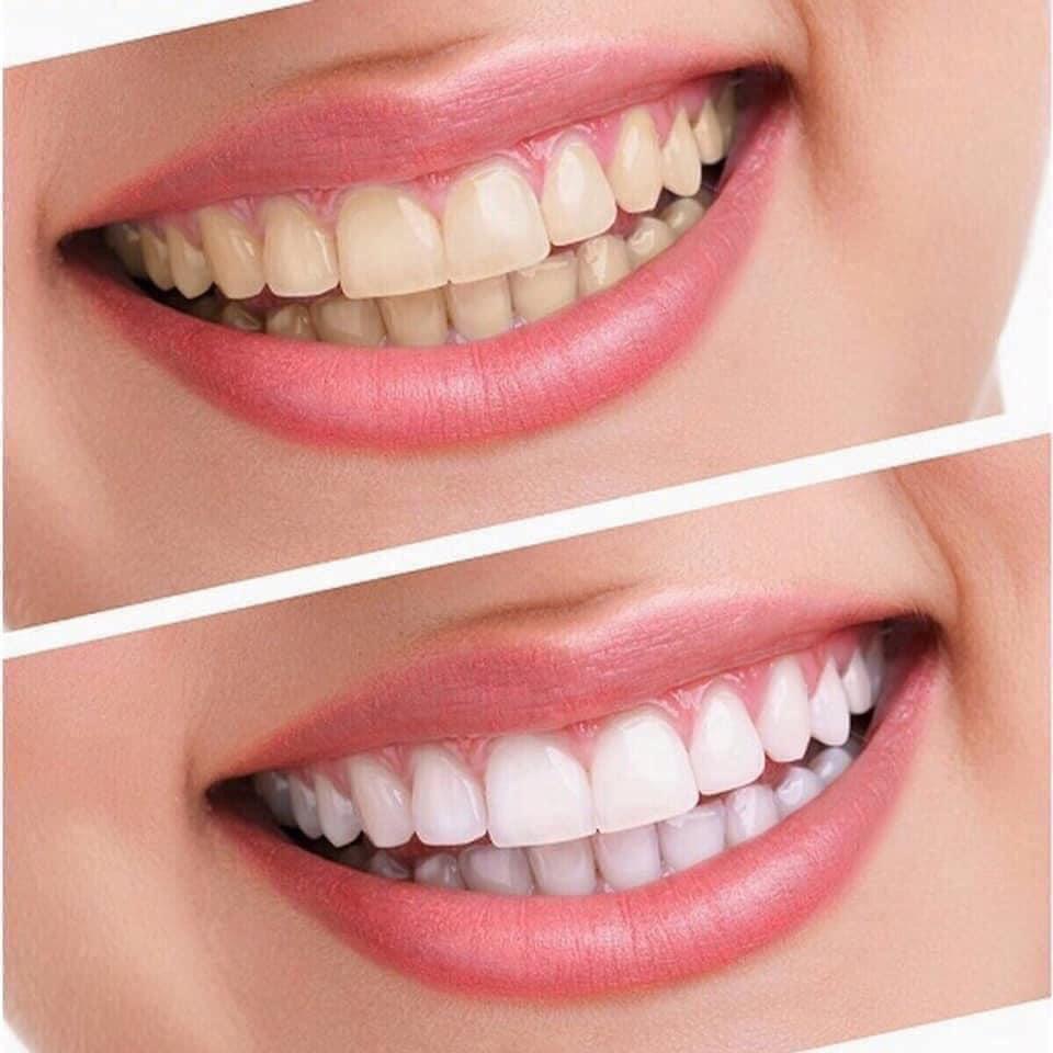 1 tuýp kem đánh răng crest 3d white advanced whitening tuýp 147g crest Mỹ