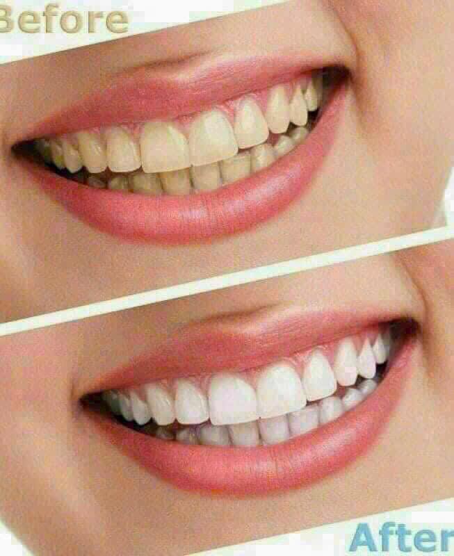 LEVEL 12 -28 Miếng dán trắng răng Crest 3D Whitestrips 1 Hour Express (Hộp 20 miếng) HÀNG MỸ