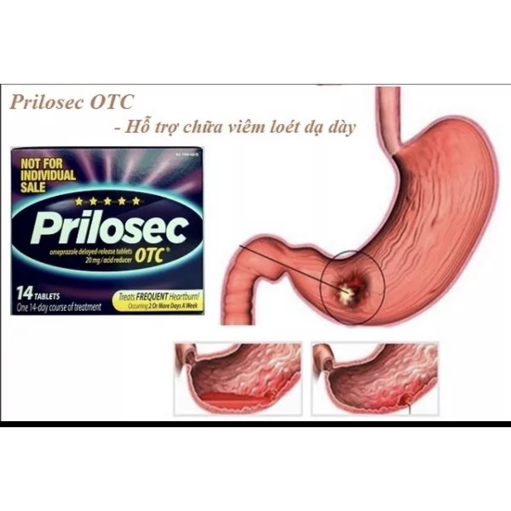 Date 5/2025 Prilốsec otc 24hr (hộp 42 viên)