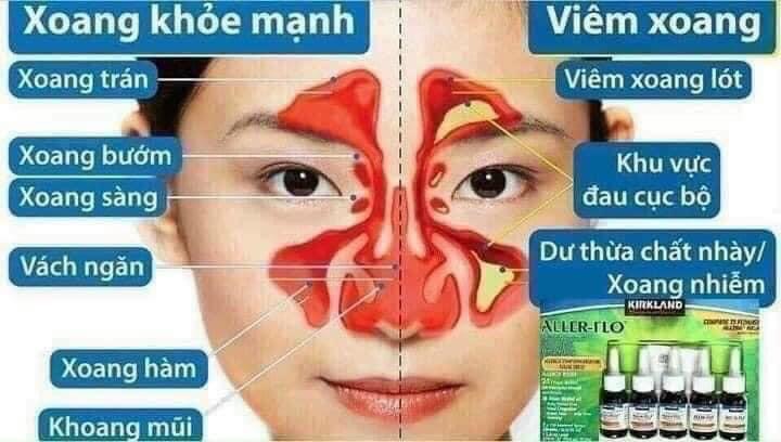 CHAI XỊT MŨI HỖ TRỢ GIẢM VIÊM XOANG VIÊM MŨI DỊ ỨNG KIRKLAND ALLER-FLO (LẺ 1 CHAI) CỦA MỸ