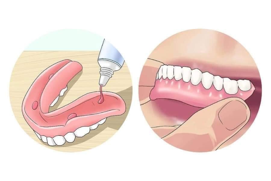 [MẪU MỚI] 1 tuýp Keo dán răng giả Fixodent 68g hàng chính hãng/ Fixodent Denture Adhesive