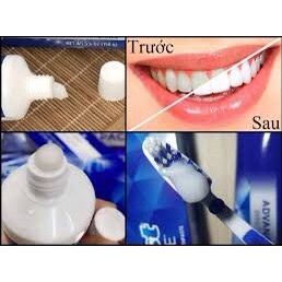 KEM ĐÁNH RĂNG CREST 3D WHITE PRO ADVANCED WHITENING LỐC 5 TUÝP CỦA MỸ