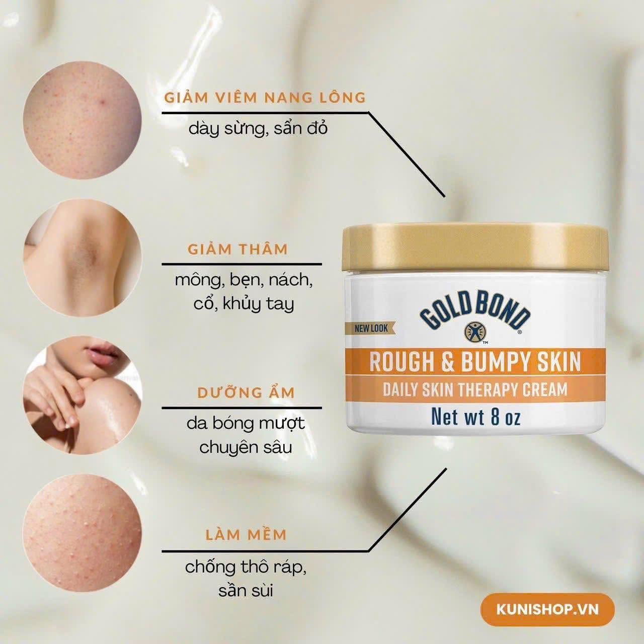 KEM DƯỠNG DÀNH CHO DA SẦN SÙI, VẢY NẾN, VIÊM LỖ CHÂN LÔNG GOLD BOND ROUGH & BUMPY SKIN DAILY SKIN THERAPY CREAM HŨ 226G CỦA MỸ
