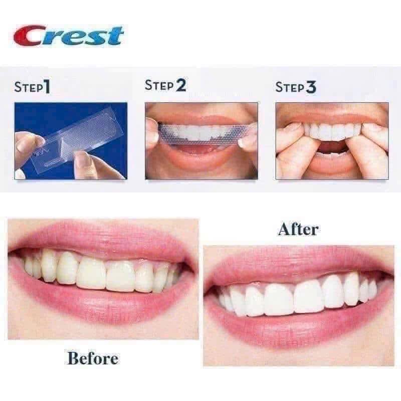 [LEVEL 8 - 14 LẦN DÁN] Miếng dán trắng răng Crest 3D Whitestrips 1-Week Smile Transformation - Bản Mỹ 28 miếng