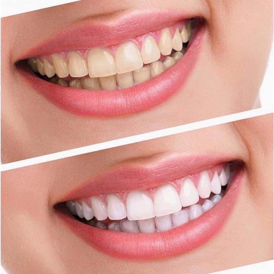 1 tuýp kem đánh răng crest 3d white advanced whitening tuýp 147g crest Mỹ