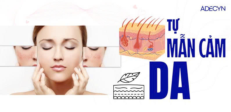 Tự mẫn cảm da