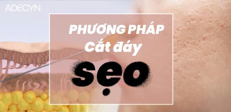 Phương pháp cắt đáy sẹo