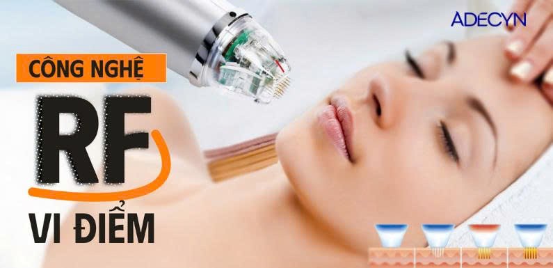 Công nghệ RF vi điểm