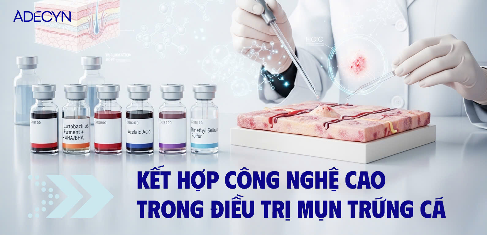 Kết hợp công nghệ cao trong điều trị mụn trứng cá